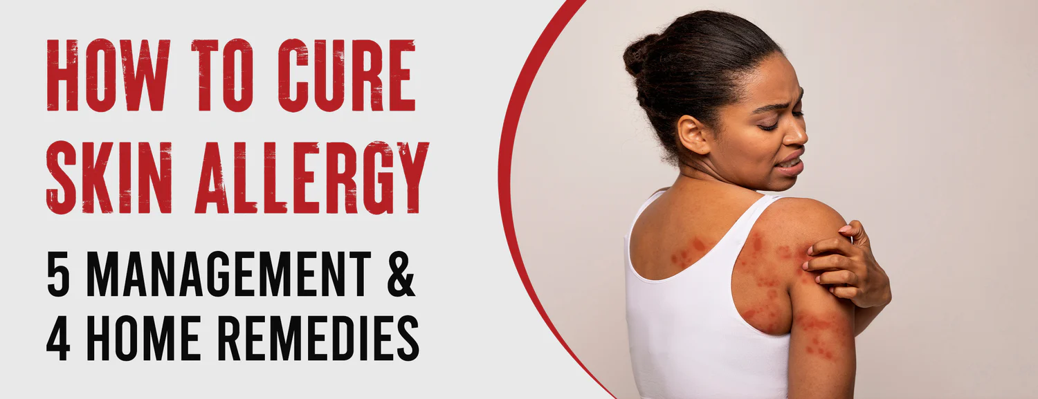 Five Best Ways to Cure Skin Allergies 2 Best Skin Allergy Treatments