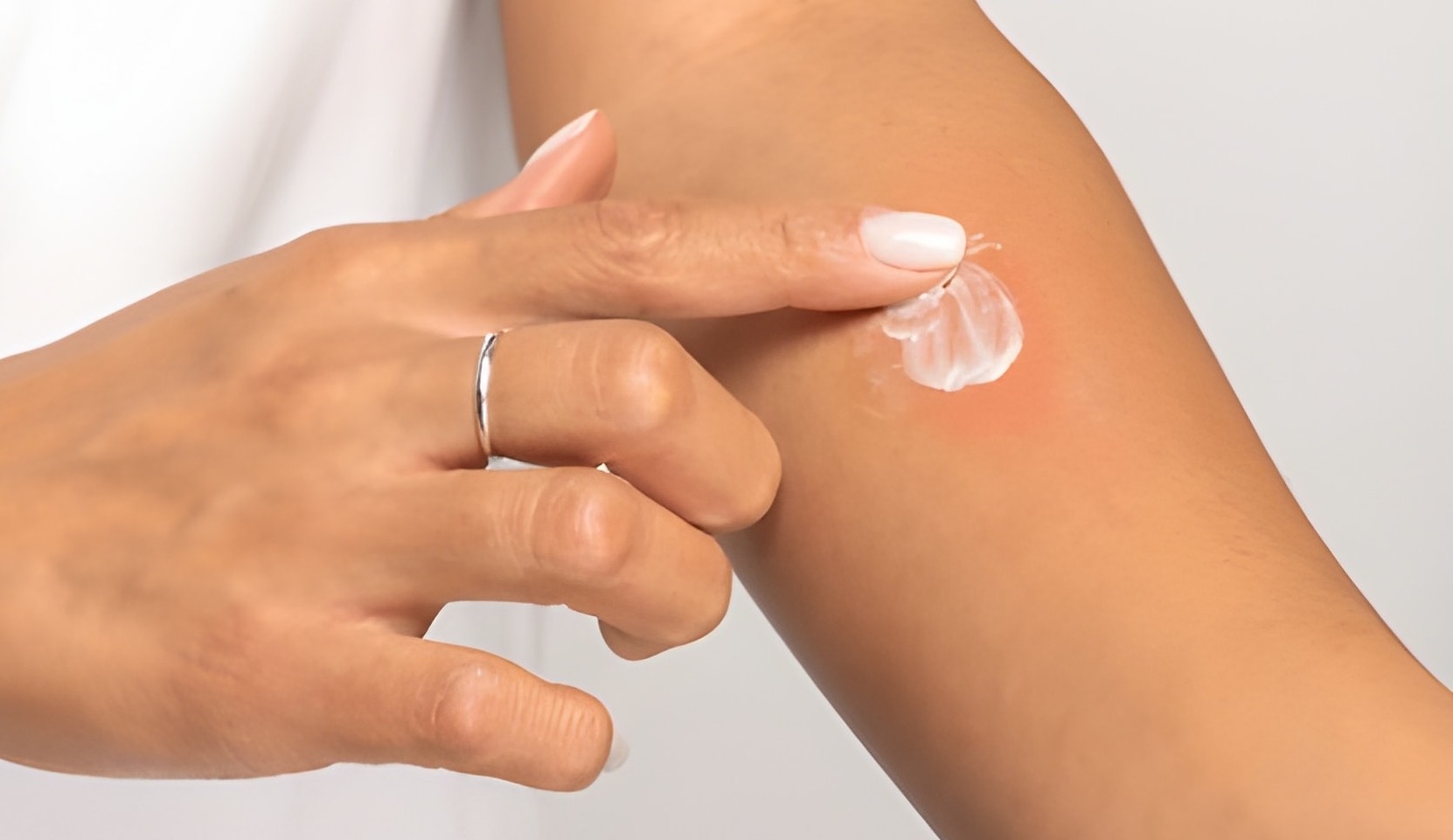 Insect Bites Treatment Methods for Muscle Pain
