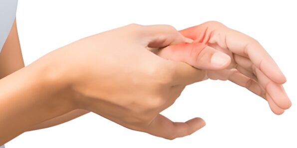 Insect bites that cause muscle pain culprits and treatments