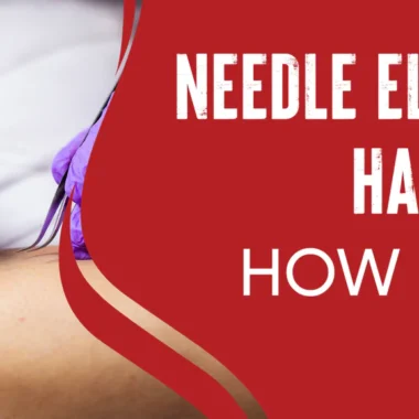Needle Electrolysis Hair Removal: How It Works [3 Types]