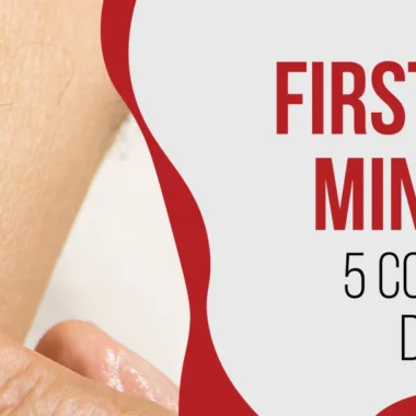 What To Do For Welding Burns on Skin | 8 Precautions