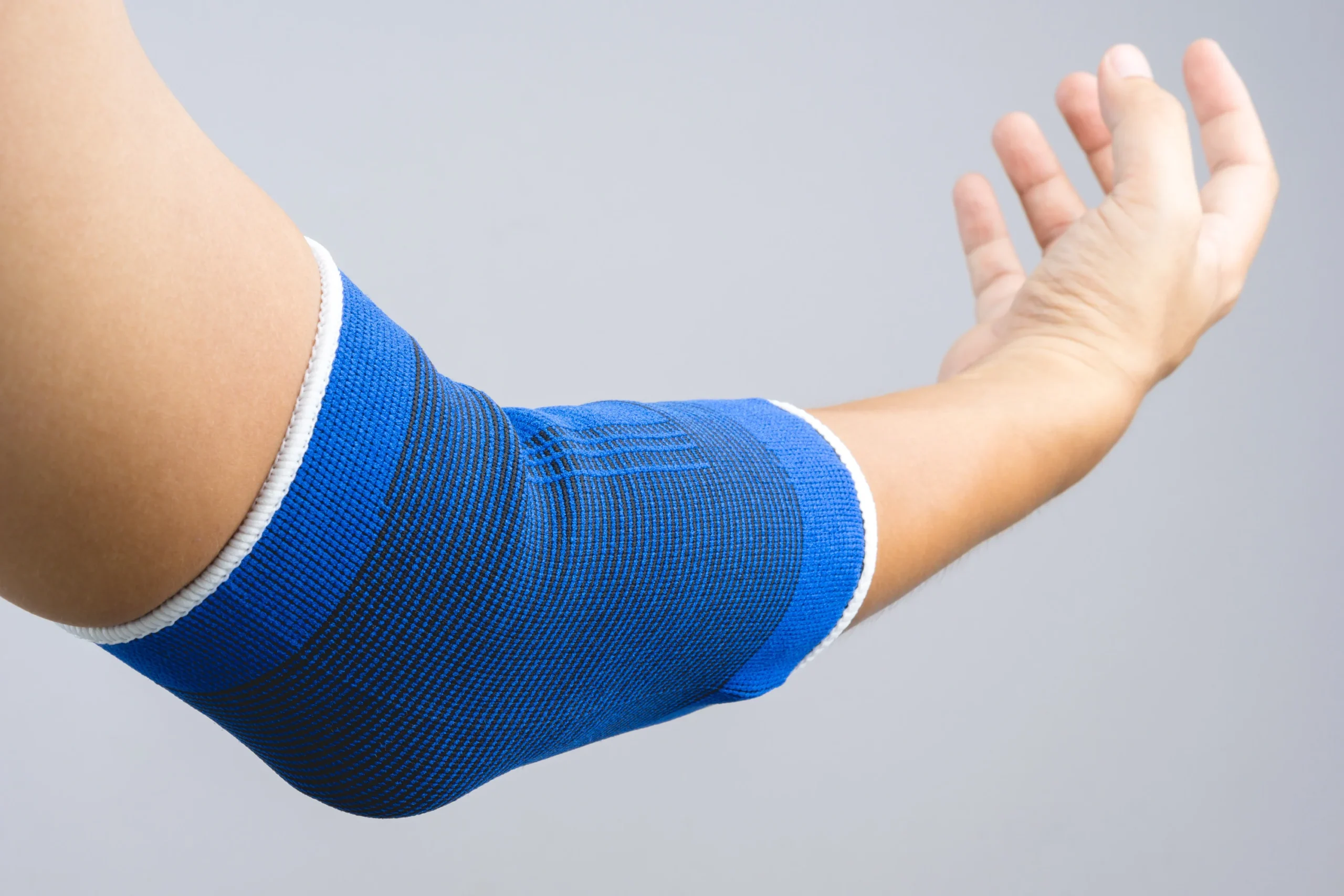 Nerve damage caused by minor third-degree burns