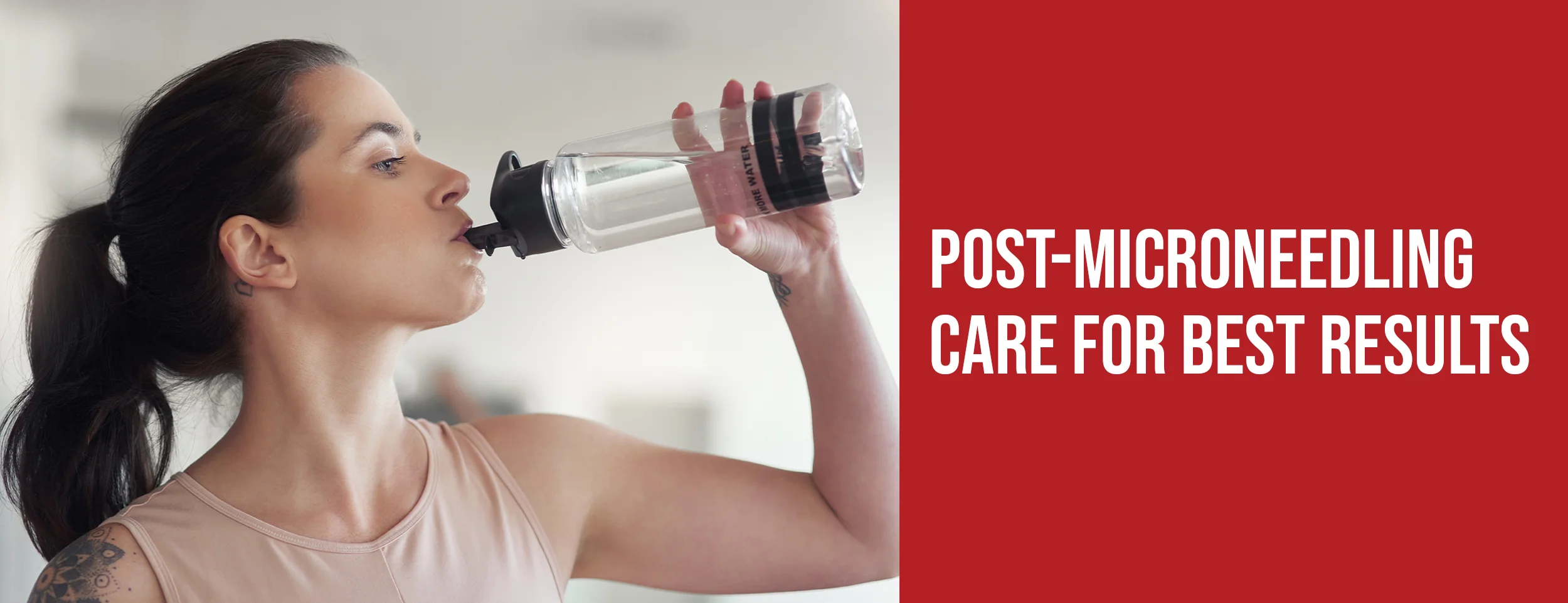 Post-Microneedling Care for Best Results