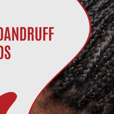 Home Remedies for Treating Pruritus Ani: 9 Tips