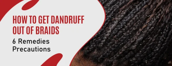 Precautions for Removing Dandruff From Braids