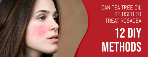 Rosacea Treatment with Tea Tree Oil 12 Methods & Things to Consider