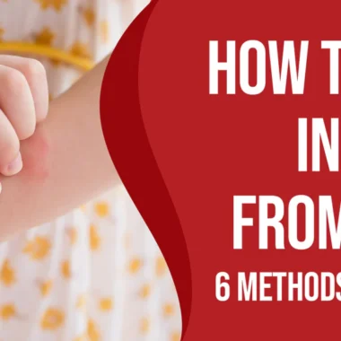 Most Painful Insect Bites: 10 Types [How to Avoid Them]