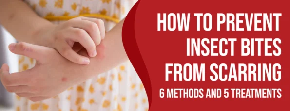 Scarring From Insect Bites