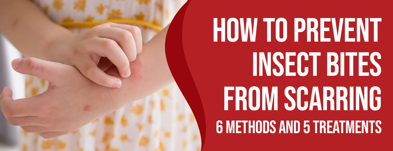 Scarring From Insect Bites