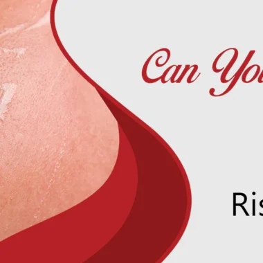 Why Is It Easy To Get A Sunburn While Swimming: 7 Reasons