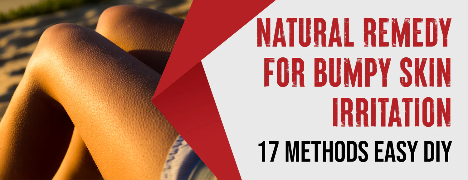 Simple DIY Methods to Treat Bumpy Skin Irritation