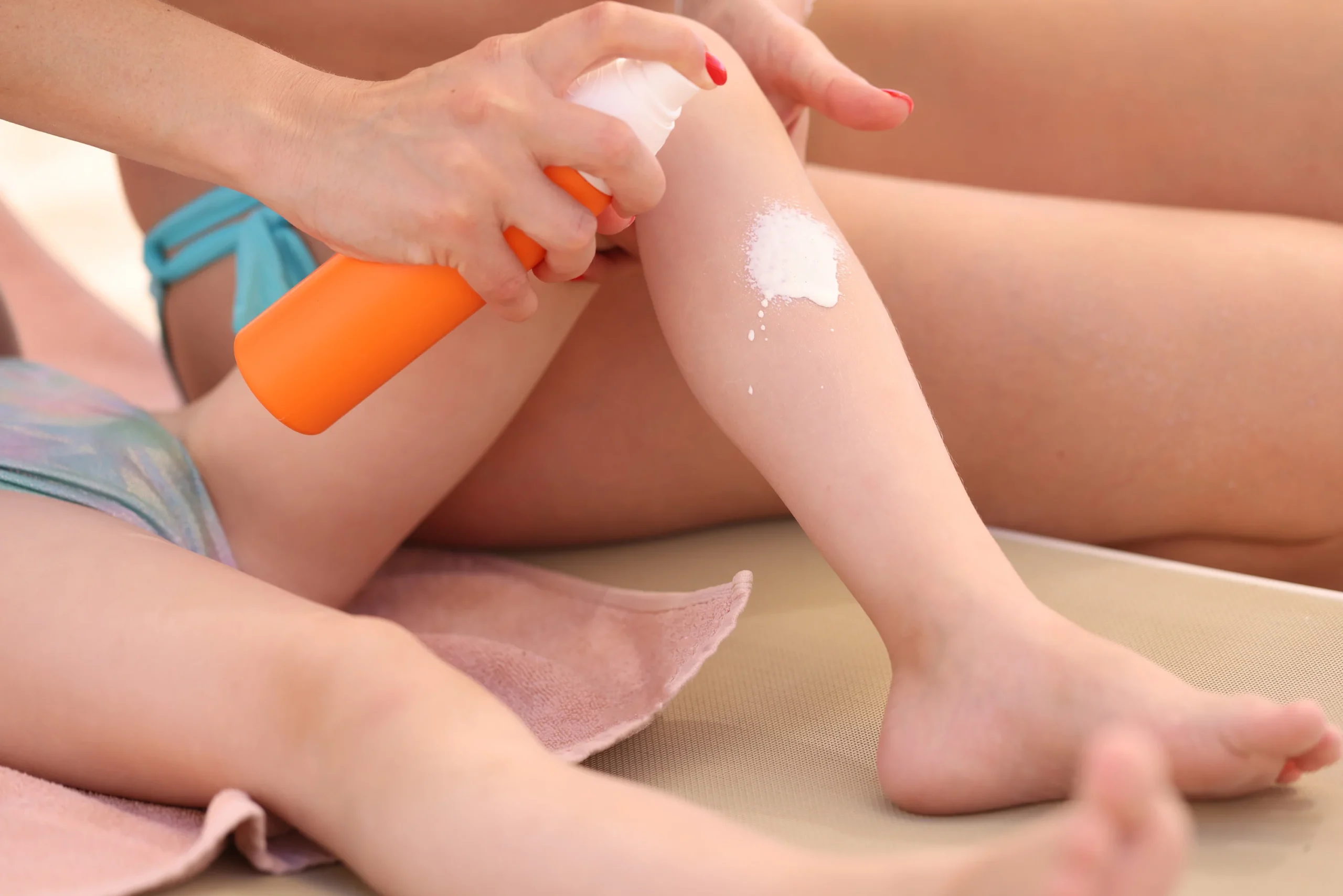 Sunburn Treatment and Prevention Methods for Babies