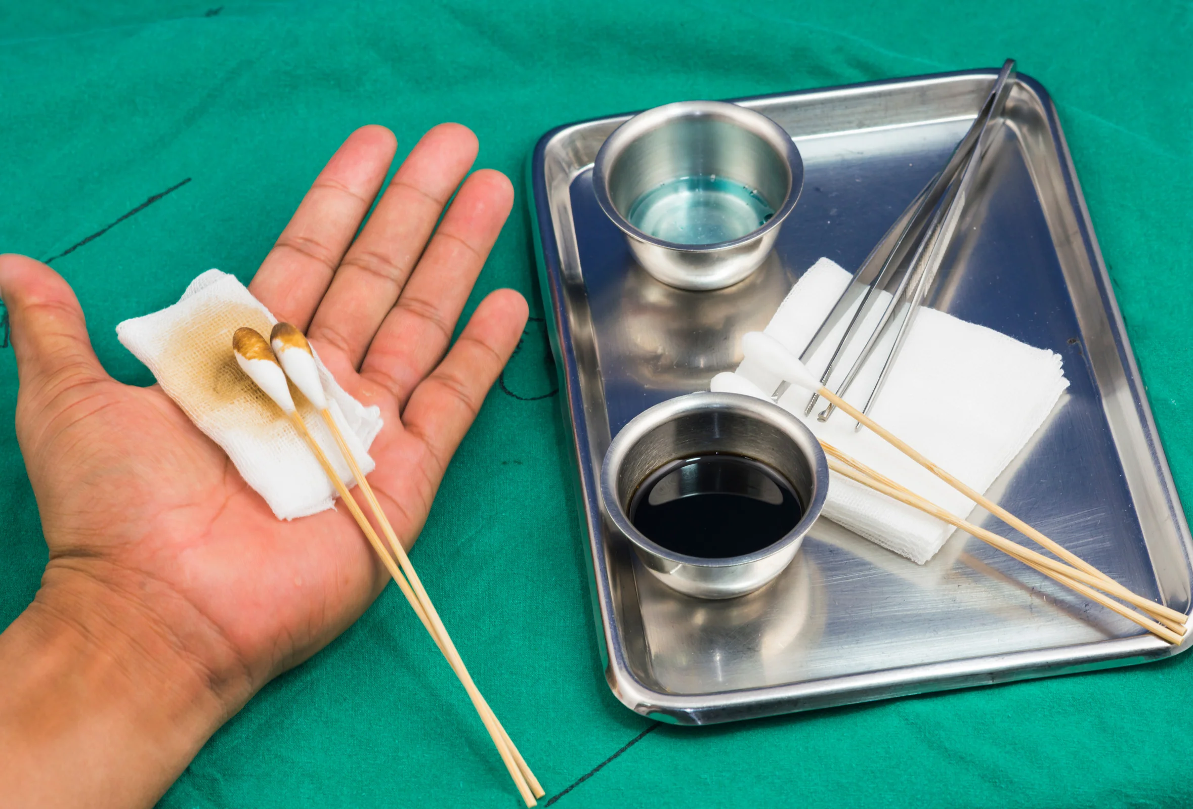 Techniques for Effective Use, What to Use for Disinfection