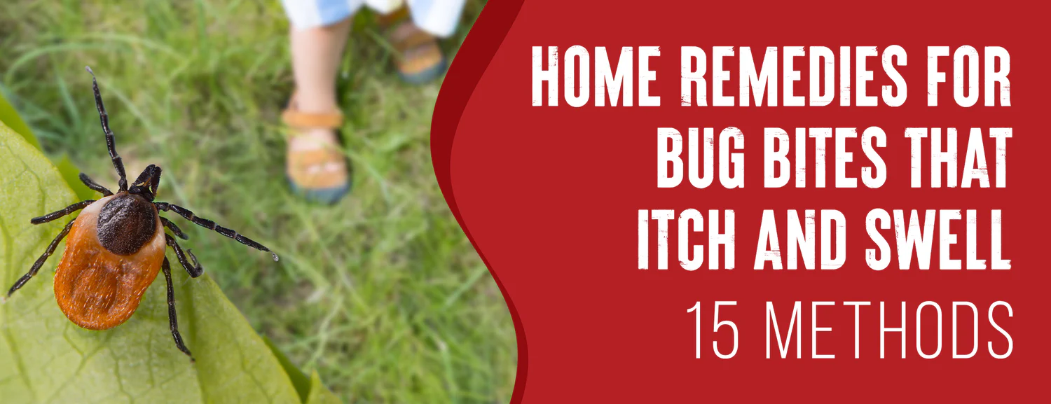 The 15 best home remedies for bug bites that itch and swell
