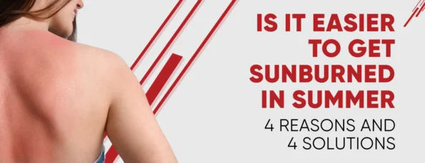 The 4 Factors that Contribute to Sunburn in Summer