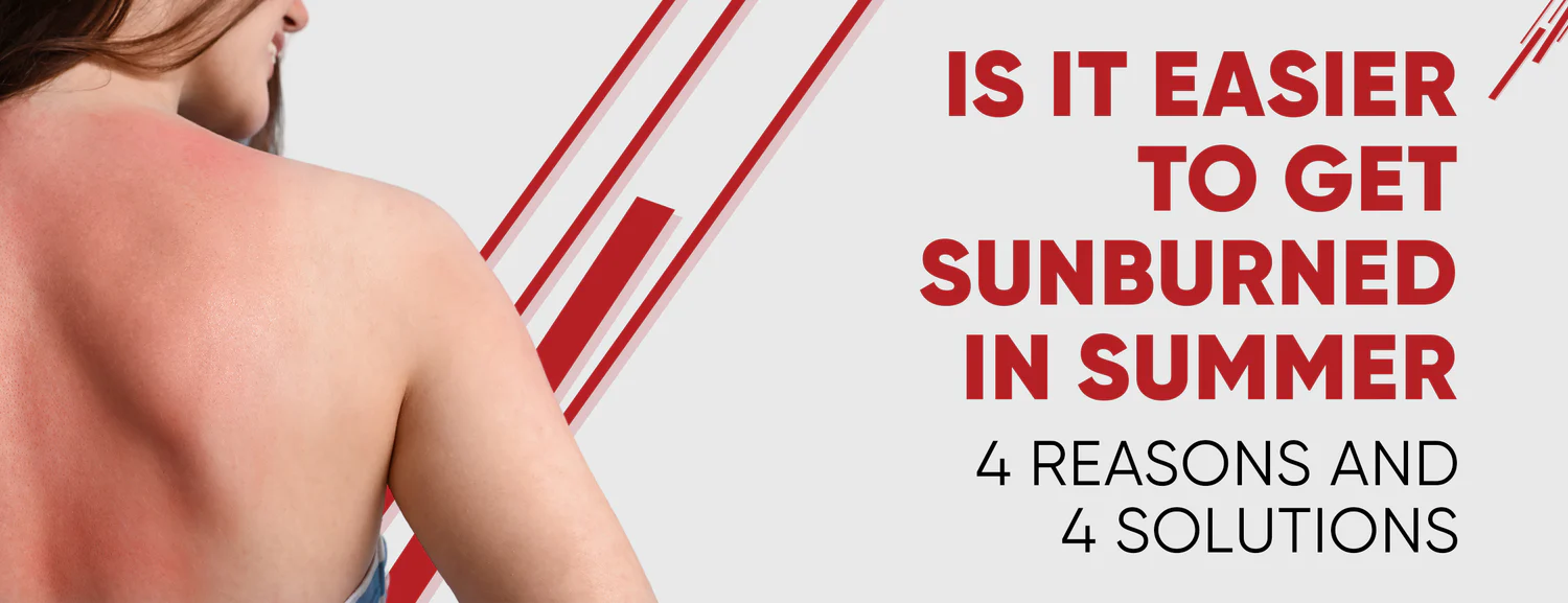 The 4 Factors that Contribute to Sunburn in Summer