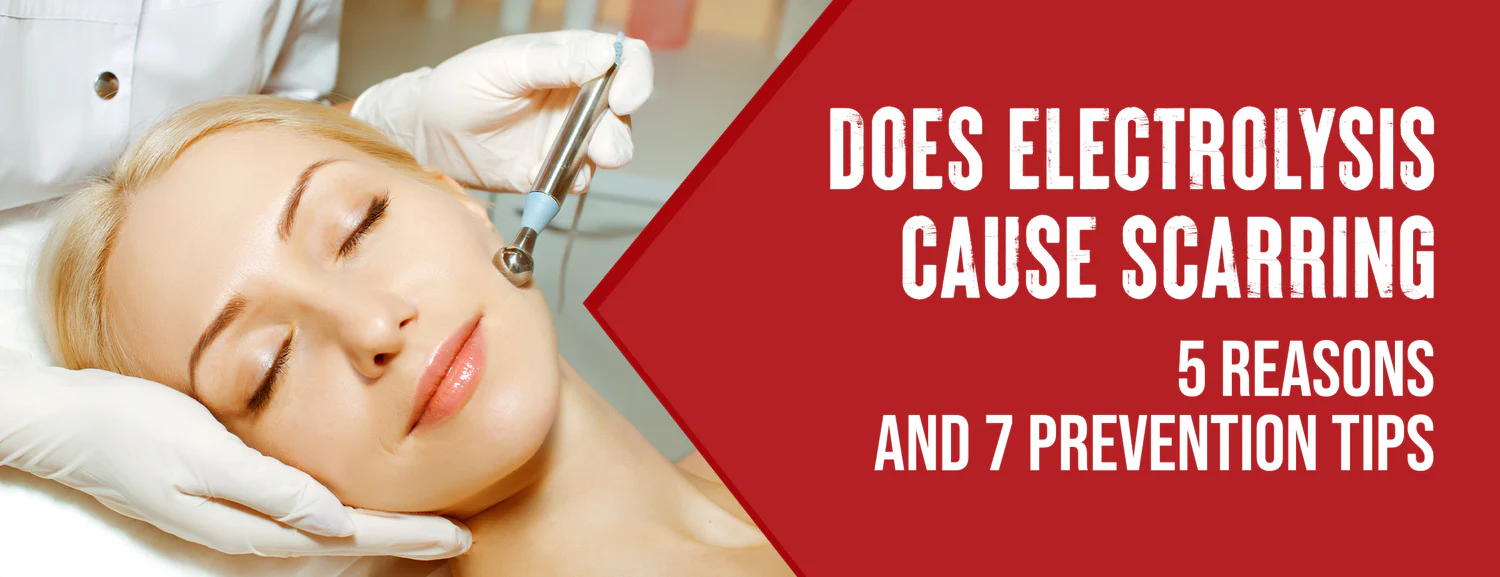 The 6 factors that cause scarring 7 tips to prevent and manage it