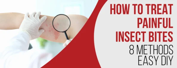 The Best Way To Treat Painful Insect Bites