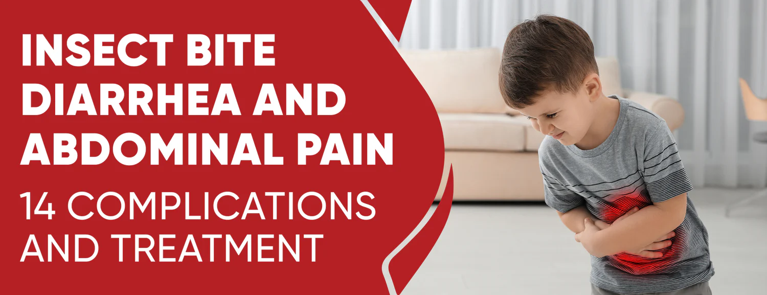 The Possible Complications and Treatment of Insect Bite Diarrhea