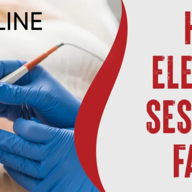 How Many Electrolysis Sessions For Facial Hair: Full Guideline