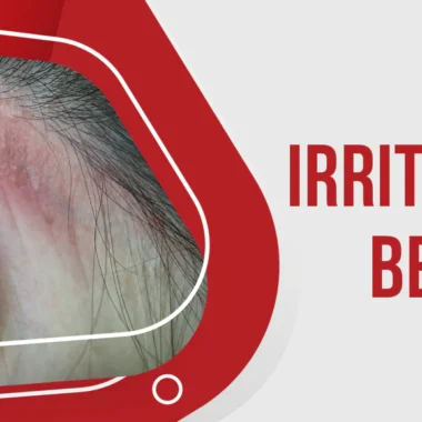 Fiberglass Skin Irritation: 8 Reasons & 2 Treatments