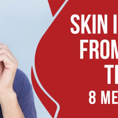 Fiberglass Skin Irritation: 8 Reasons & 2 Treatments