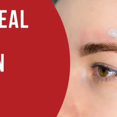 What To Do For Welding Burns on Skin | 8 Precautions