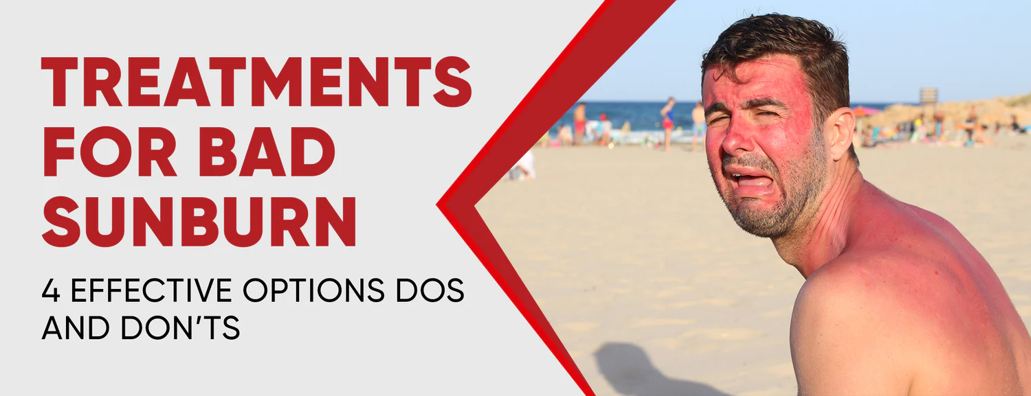 Ways to treat bad sunburns