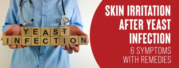 Yeast infection is a common cause of skin irritation
