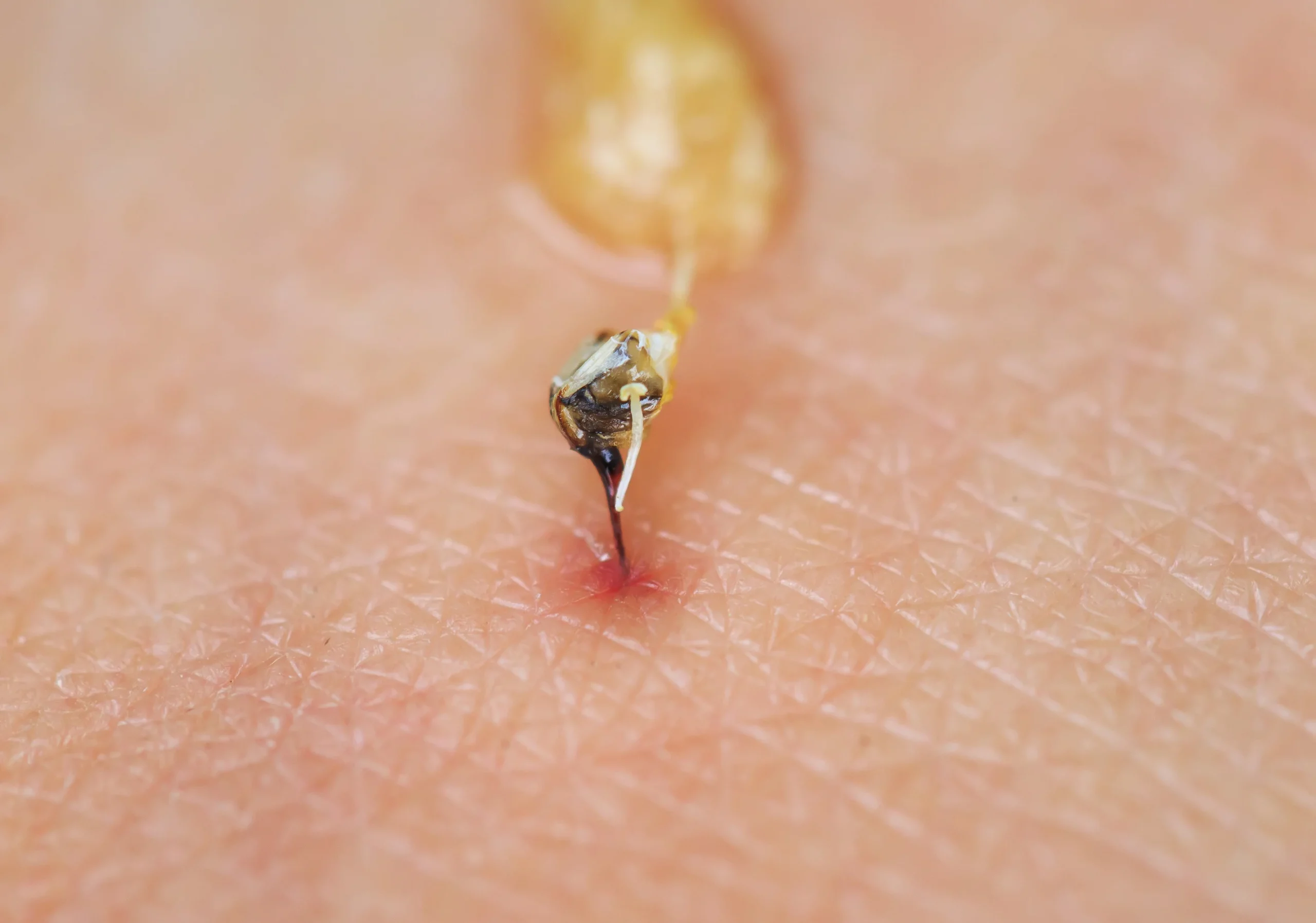 venom type and potency affect bite pain