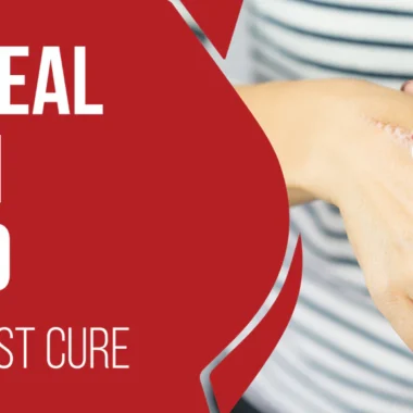 Diabetic Wound not Healing: 6 Factors  [Impact Explained]