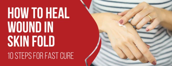 10 Essential Processes To Heal Wounds In Skin Folds & 5 Preventions