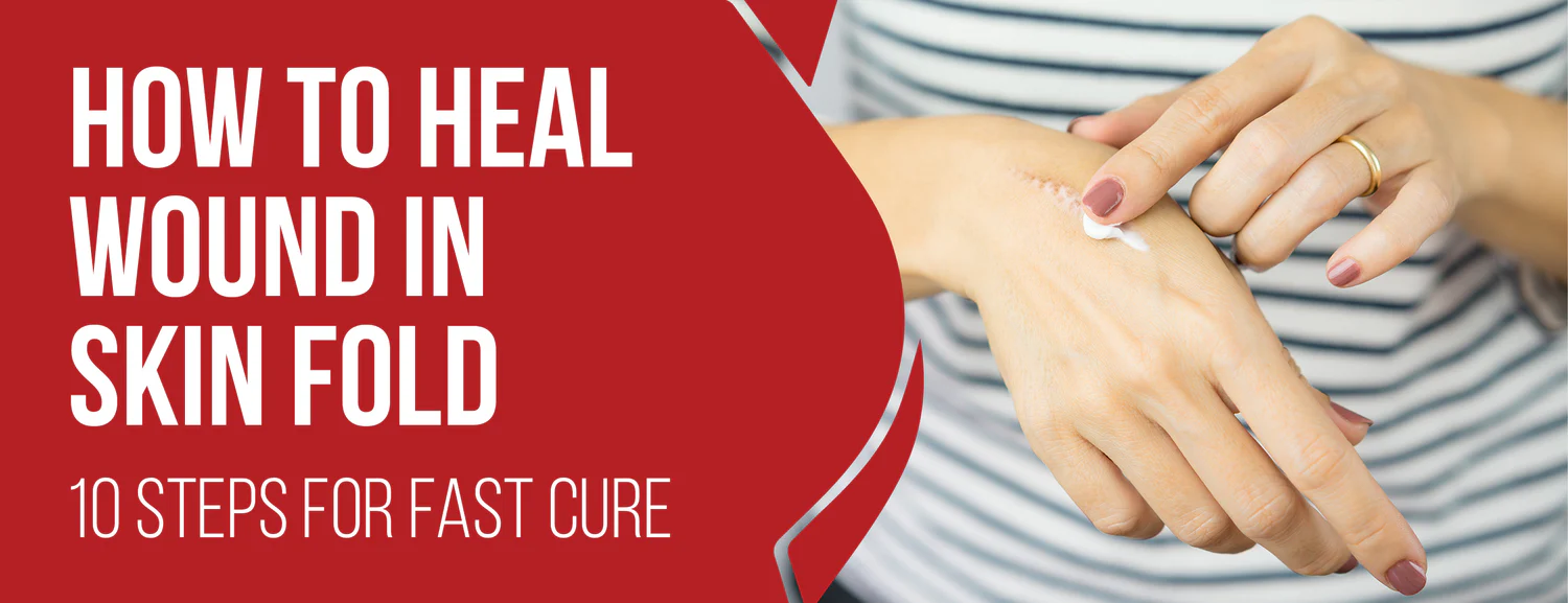 10 Essential Processes To Heal Wounds In Skin Folds & 5 Preventions