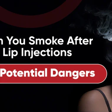 What Not to Do Before Lip Injections: 9 Tips [For Safety]