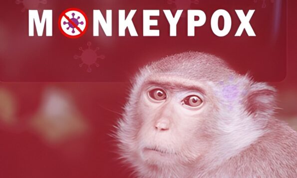 3 Mechanisms and 4 Factors of Monkeypox Immunity