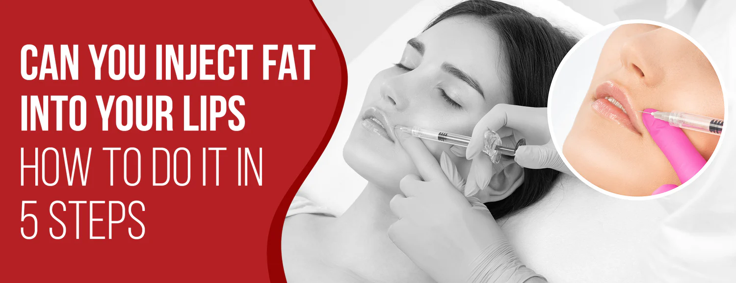 5 Steps & Factors for Injecting Fat in Your Lips
