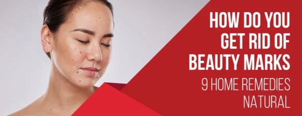 6 Home Remedies and 3 Natural Ingredients for Ridding Your Skin of Beauty Marks