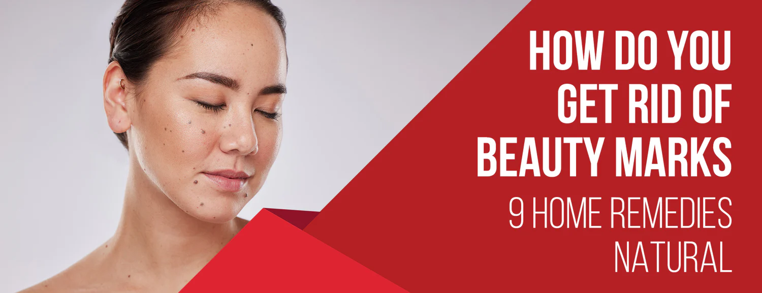 6 Home Remedies and 3 Natural Ingredients for Ridding Your Skin of Beauty Marks