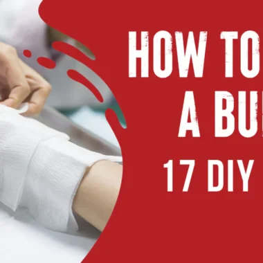 Disinfect Wound with Hand Sanitizer: 5 Tips [With Mistakes]