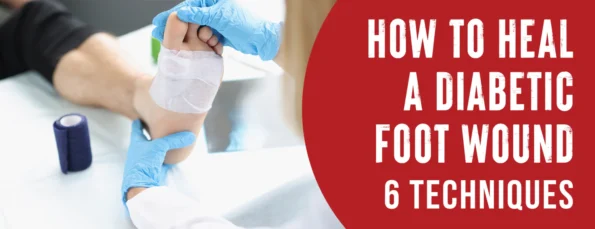 An overview of how diabetic foot wounds can be treated