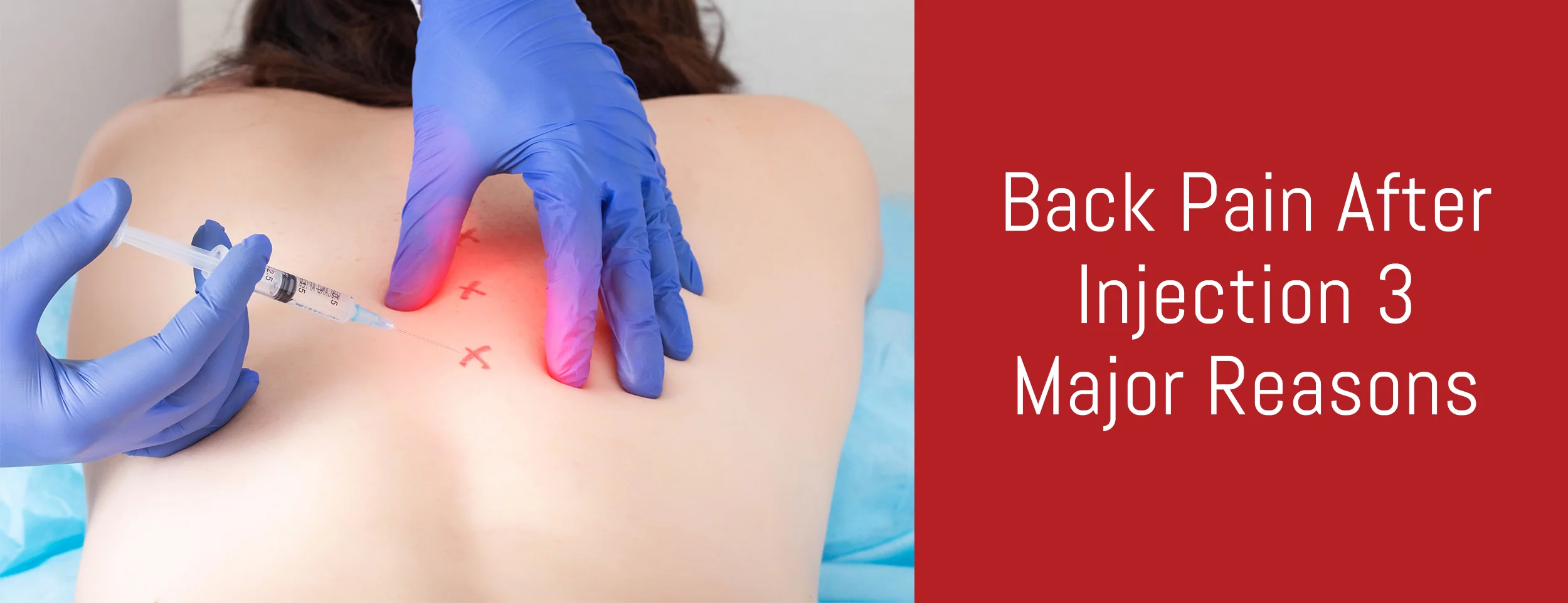 Back pain after injections can be caused by several things