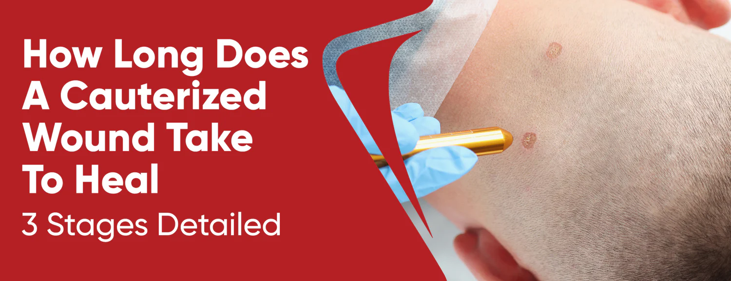 Cautionized Wound Healing 3 Stages & Timeframe