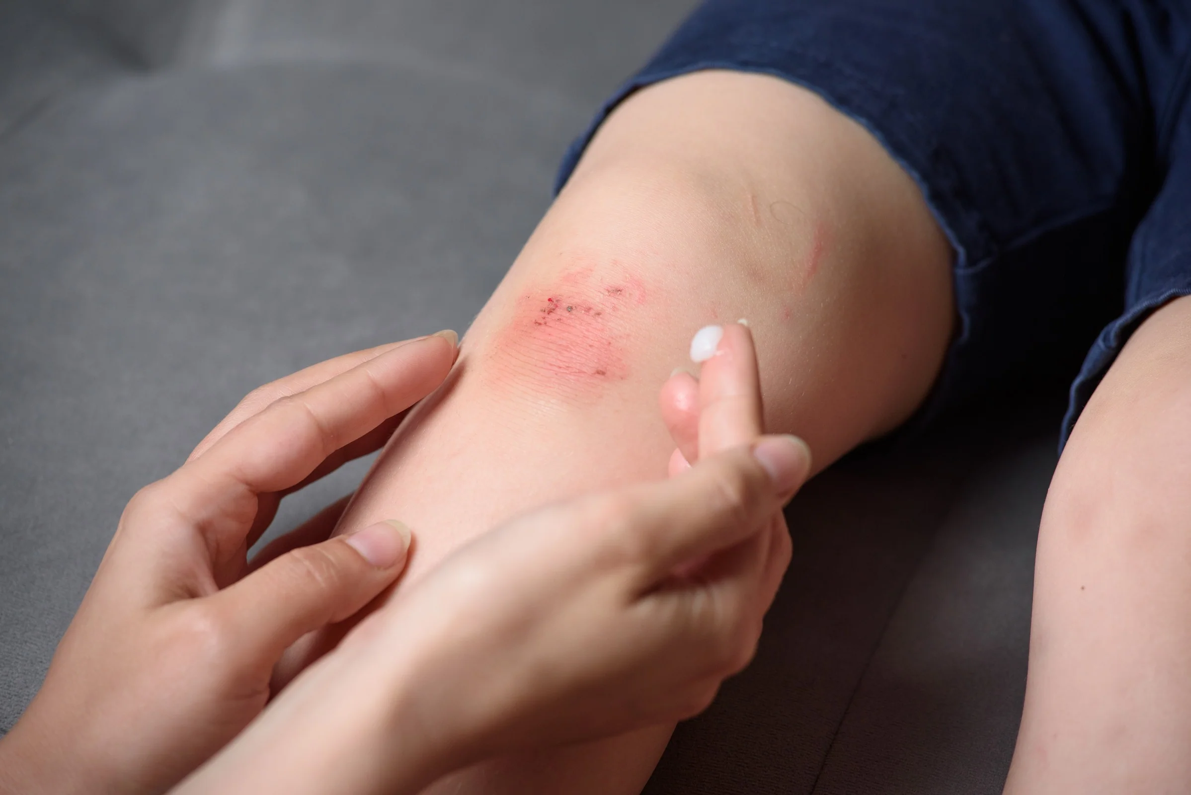 Cover the wound with antibacterial ointment