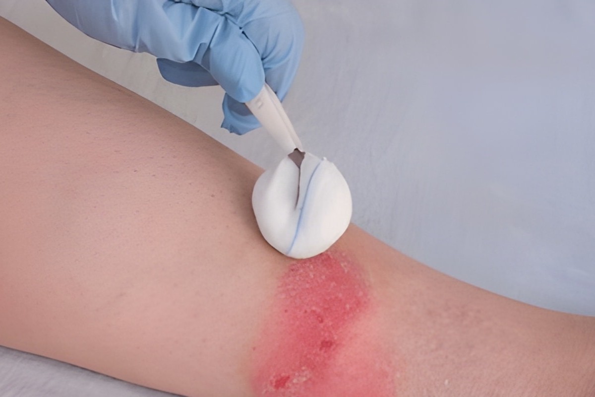 Home remedies and medical care to heal diabetic wounds faster