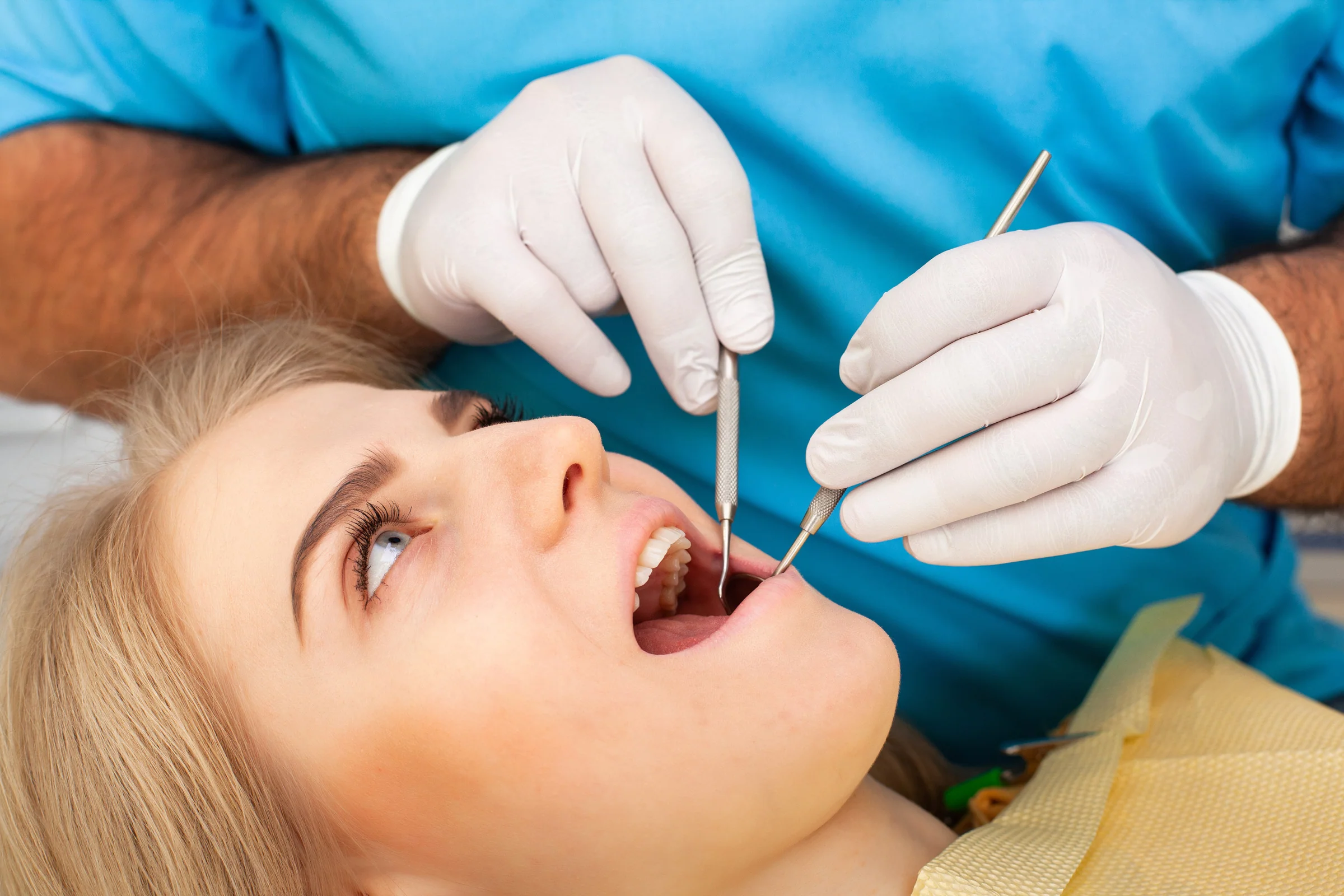 Minor surgeries Wisdom teeth removal
