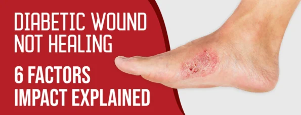 Six factors responsible for diabetic wounds not healing