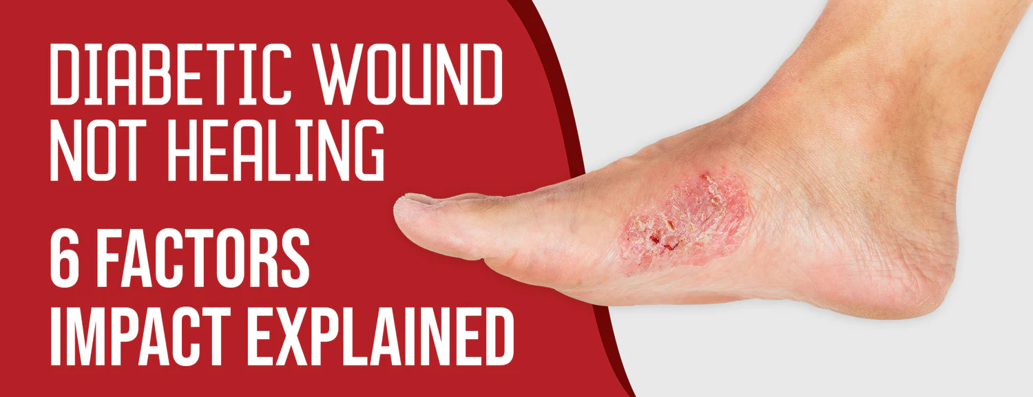 Six factors responsible for diabetic wounds not healing