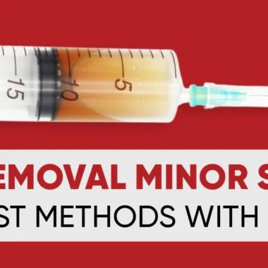 Common Minor Surgeries: Top 5 & Benefits with Risks