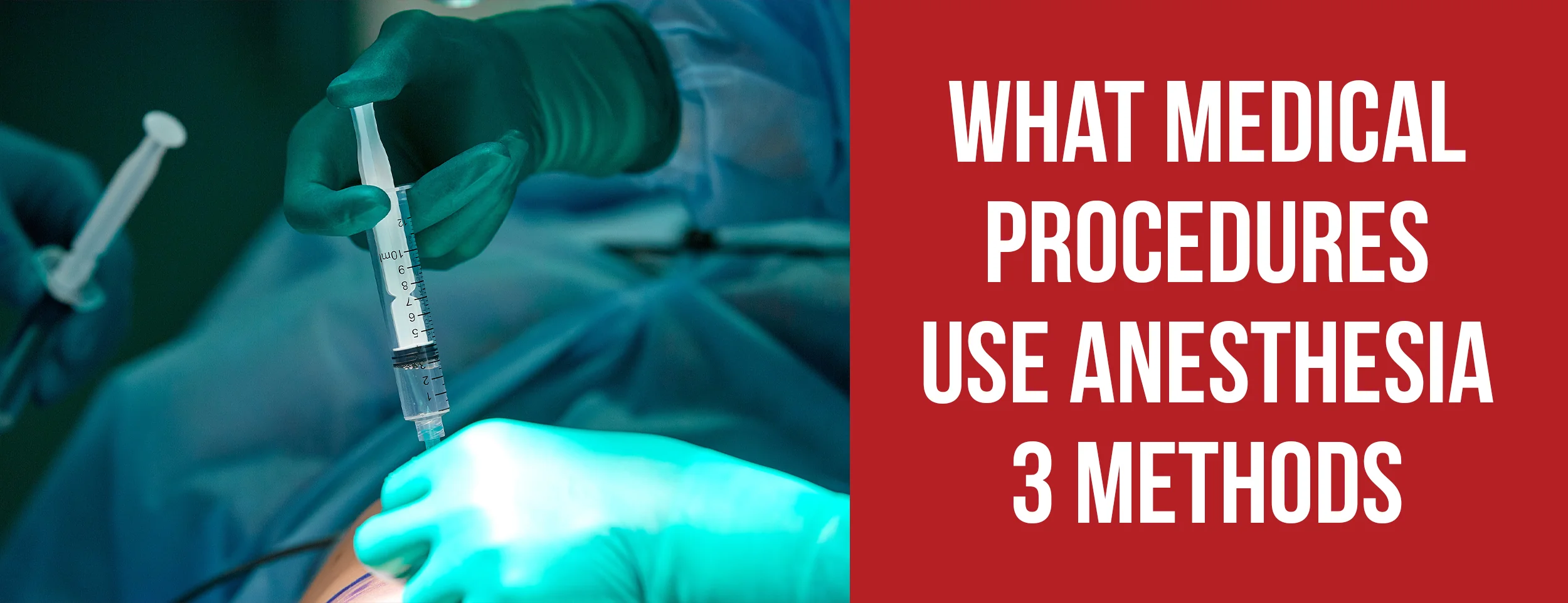 The 3 methods used in anesthesia for medical procedures