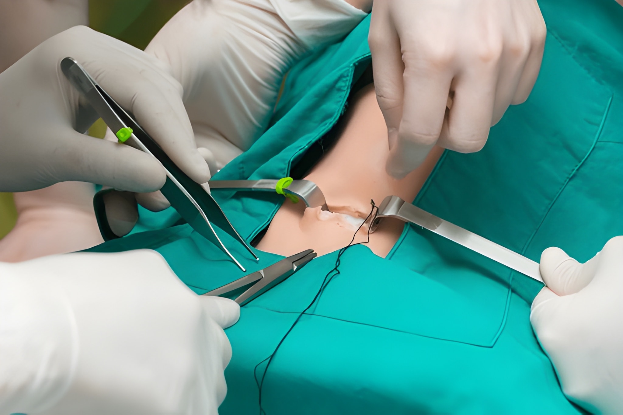 The 3 reasons for depression after minor surgery